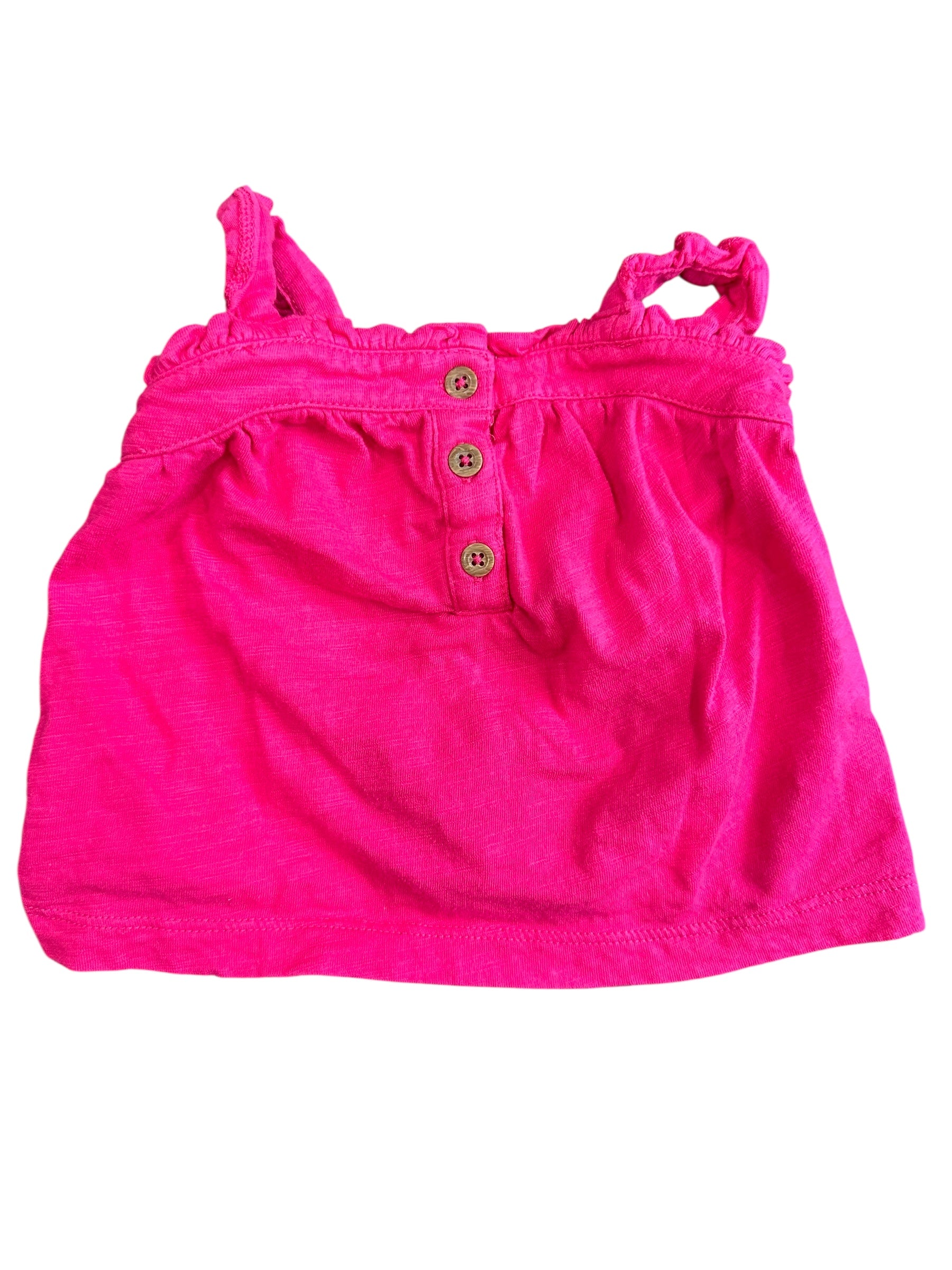 Pink Button Tank (3m)